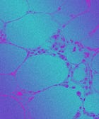 What Pregnancy Can Do To Your Skin &mdash; & How To Avoid It