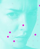 Ask A Scientist: Why Does Stress Make Me Break Out?