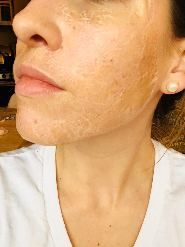 Skin1004 Zombie Pack Skin Tightening Face Mask Review