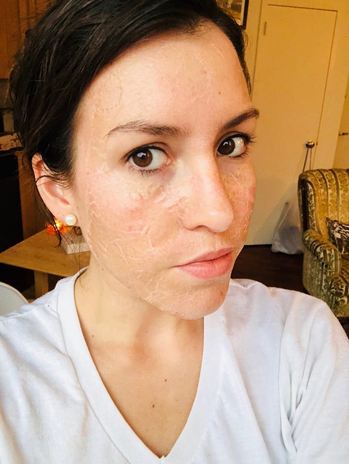 Skin1004 Zombie Pack Skin Tightening Face Mask Review