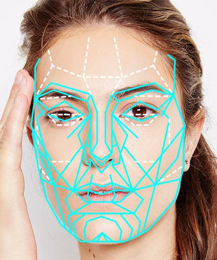 Facial fullness veneers