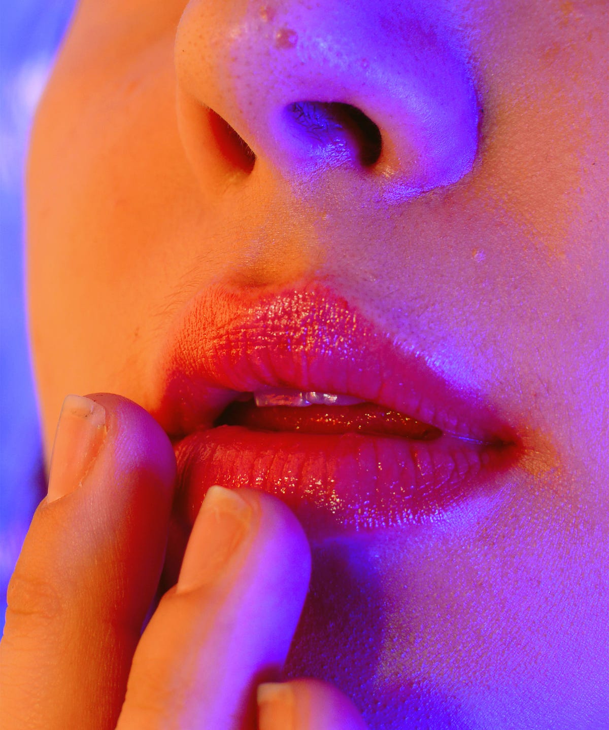 Ed Mouth Corners Angular Cheilitis Treatment Tips
