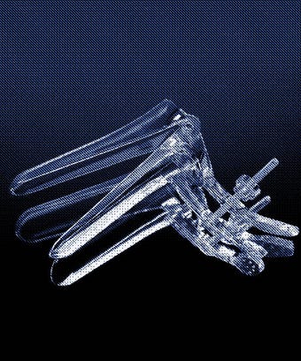 papsmear