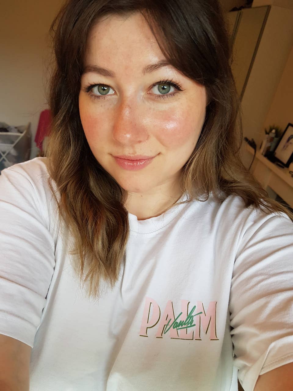 acne post birth control