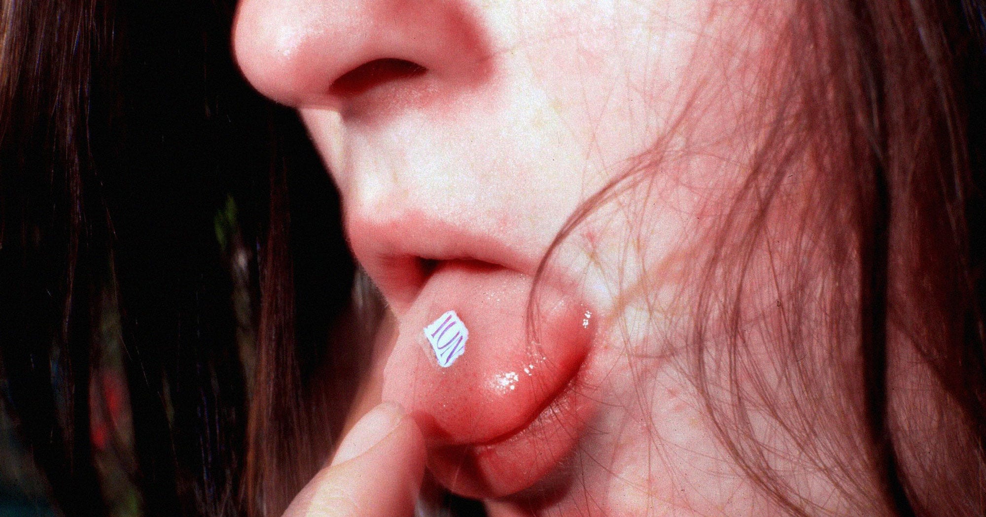 LSD Acid Brain Scan Effects Imaging Study